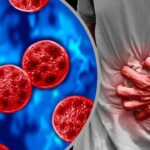 More Than 27,000 Cyclosporiasis Cases Reported Across 47 States as FDA Expands Recall of Potentially Contaminated Lettuce