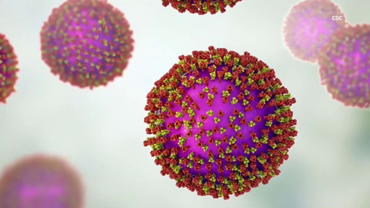 Measles Exposure Warning Issued Across California After Passenger Rides Trains and Buses Through 6 Counties