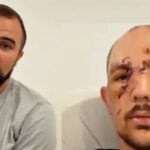 Washington Father Bitten in the Face by Bear During Alaska Hunting Trip, Says He Thought He Would Die