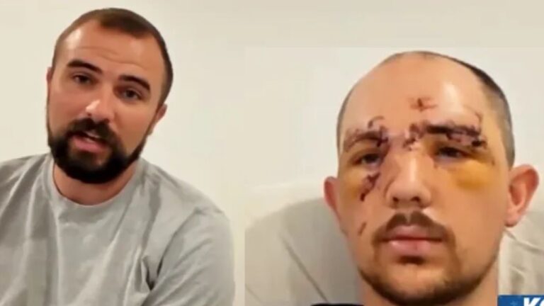 Washington Father Bitten in the Face by Bear During Alaska Hunting Trip, Says He Thought He Would Die